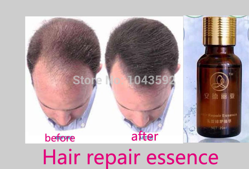 regrow hair vitamins